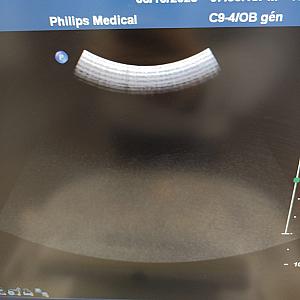 Sonde convexe C9-4 - Bon état