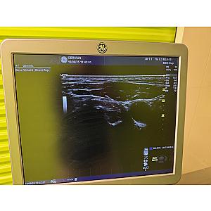 Sonde Convexe ML6-15-D - État correct